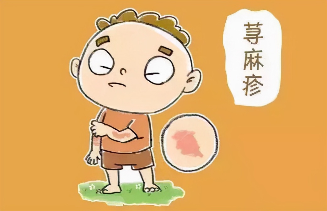 反反复复被荨麻疹困扰?花2分钟来了解一下,这小小一味路路通吧