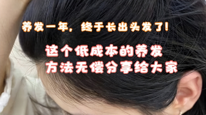熬夜加班掉发慌？康丽焕发精华救我狗命，3 个月养出满头小碎发