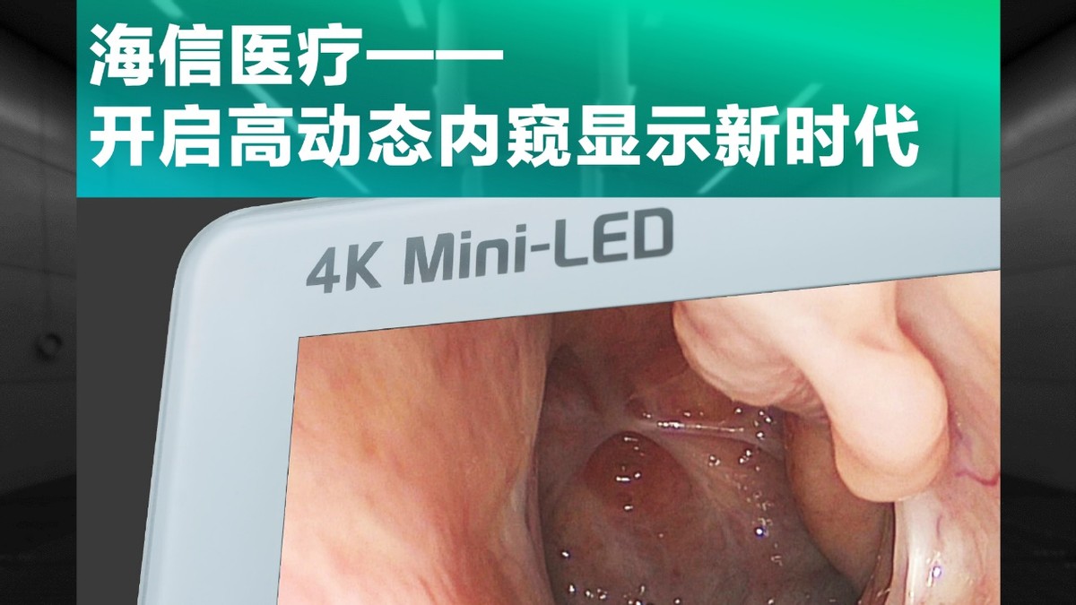 用天花板顶破天花板!海信医疗摘下“皇冠上的明珠”