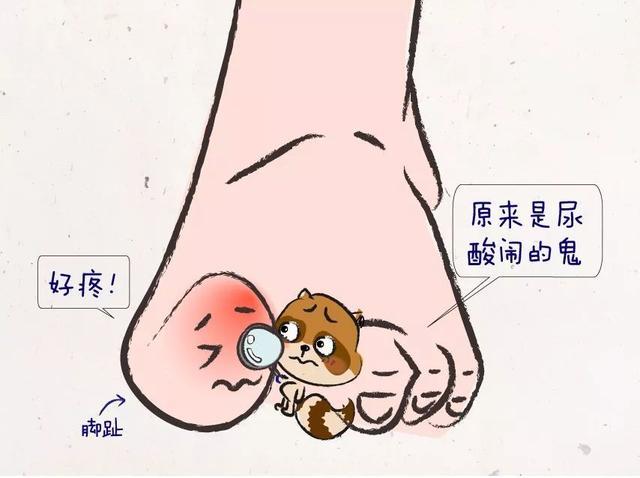 如何判断体内的尿酸升高？出现这三种情况就要注意了